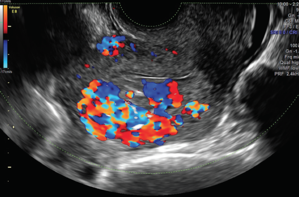 Color Doppler Centromedica